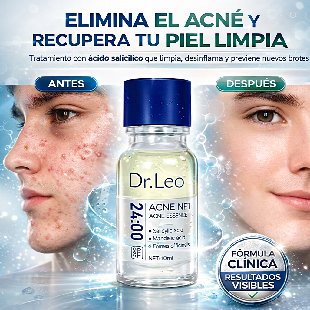 Tratamiento facial para el acné con ácido salicílico Dr. Leo