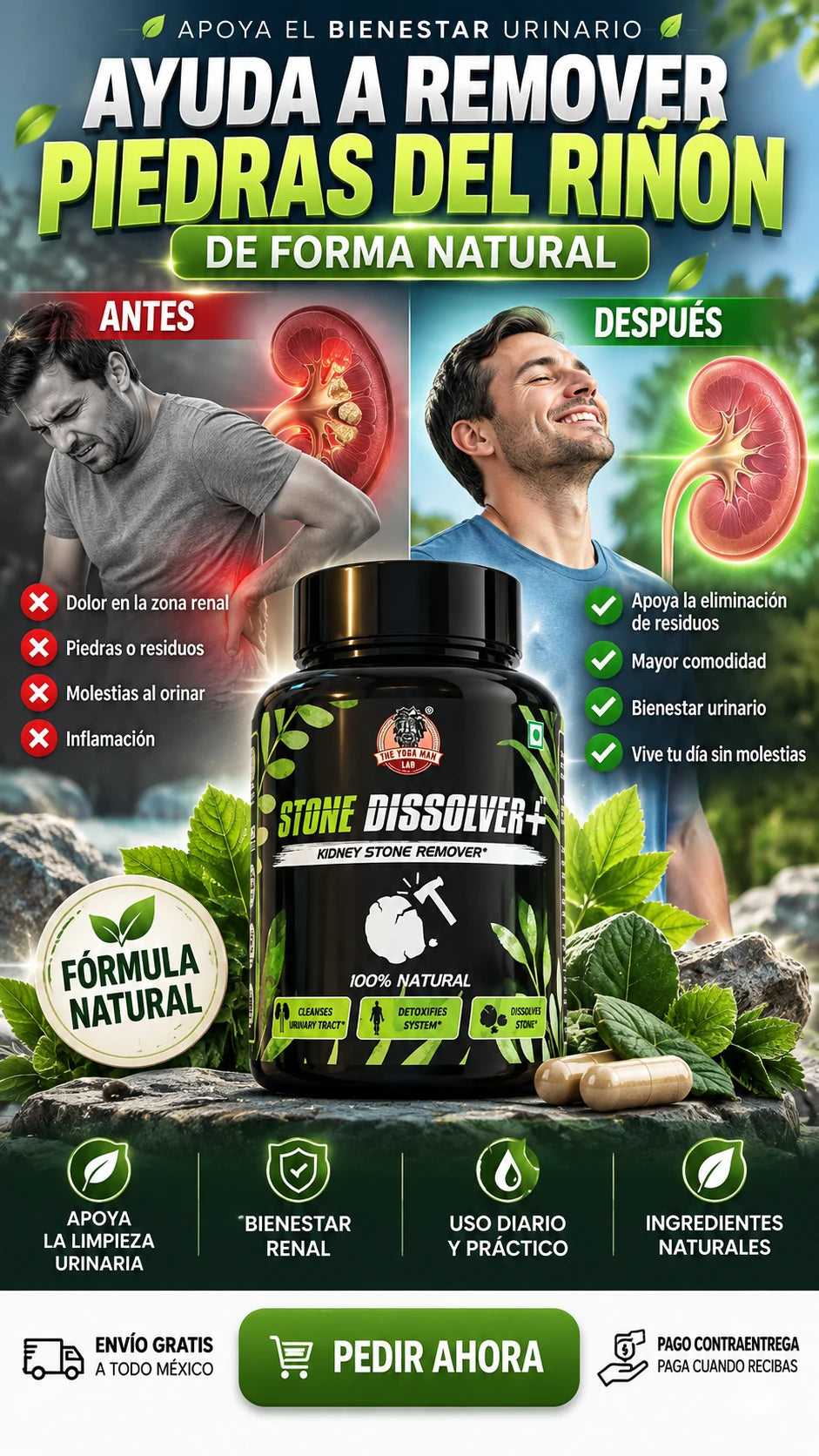 Suplemento Stone Dissolver+ — Apoya la eliminación natural de residuos