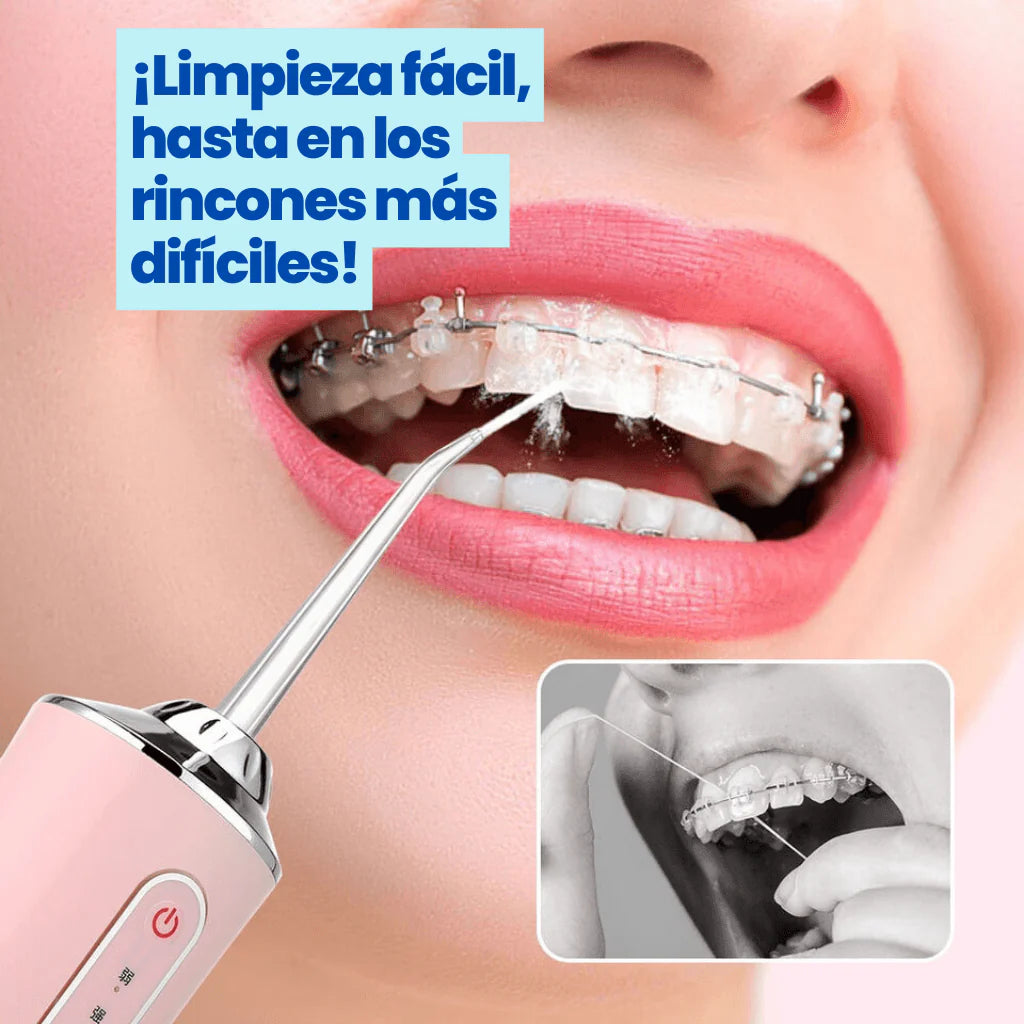 HydroSmile Pro™- ¡Dile adiós al sarro, al mal aliento y a las caries en solo semanas!