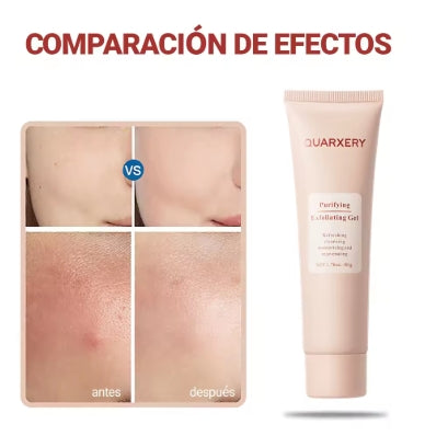 QUARXERY Gel Exfoliante Facial Limpiador Hidratante con Nicotinamida - Skin Care Belleza, Gel Limpiador Facial Exfoliante Corporal para Piel Grasa, Seca y Mixta