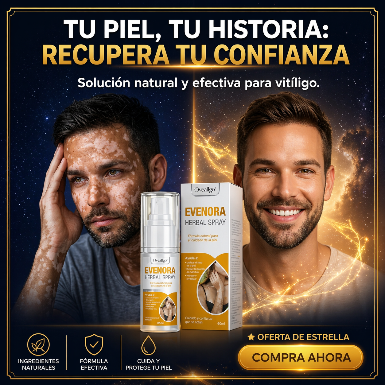 EVENORA HERBAL SPRAY- Solucion natural para vitiligo en hombres