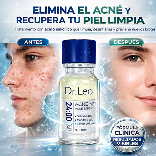 Tratamiento facial para el acné con ácido salicílico Dr. Leo
