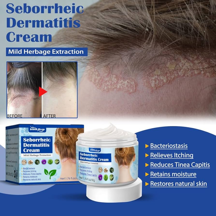 Crema para Dermatitis Seborreica South Moon | Alivio del Picor, Escamas y Rojeces | 50g