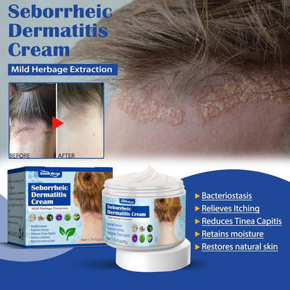 Crema para Dermatitis Seborreica South Moon | Alivio del Picor, Escamas y Rojeces | 50g